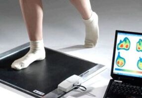 Diagnóstico de hallux valgus