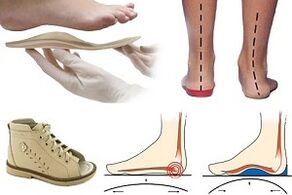 Zapatos ortopédicos para hallux valgus nun neno