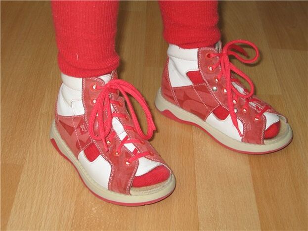 Zapatos para nenos con hallux valgus